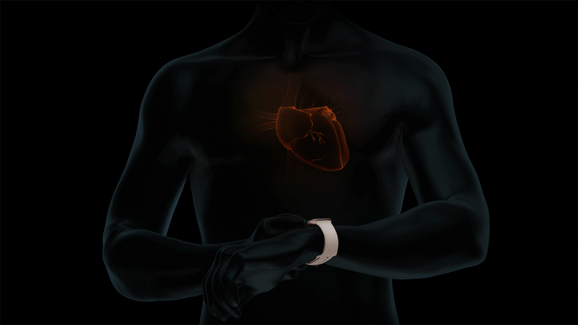 Apple Watch Series 4 kann jetzt auch in Deutschland zur EKG-Messung eingesetzt werden. (Bild: Apple)