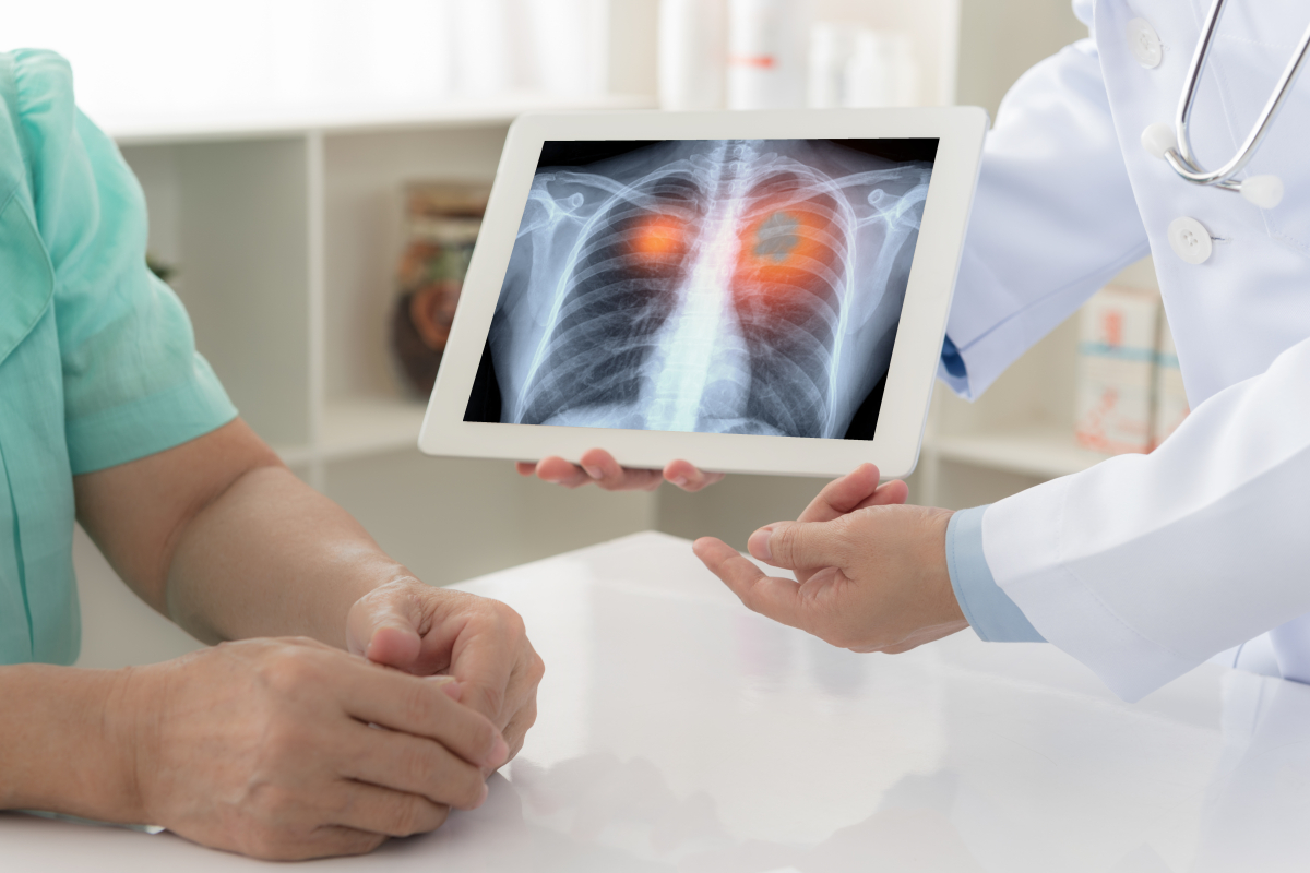 Vorsorge gegen Lungenkrebs: MIT und Krankenhaus entwickeln KI-System