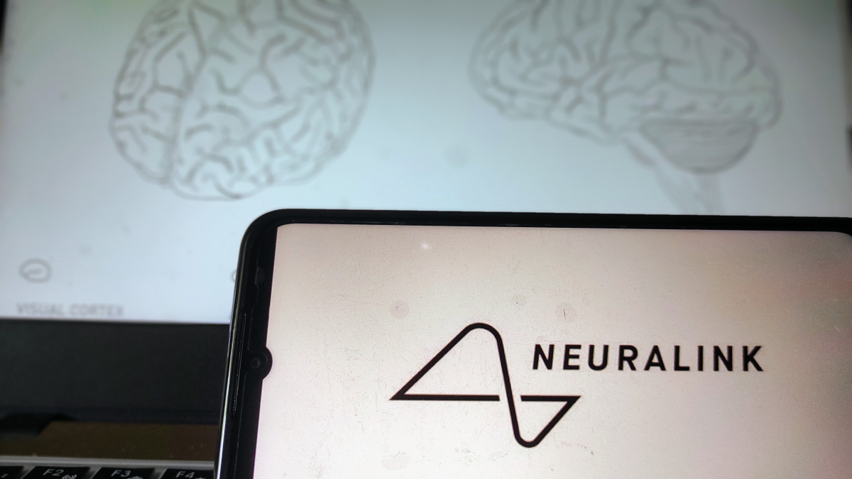 Elon Musk's Neuralink company had a problem with its brain chip after all